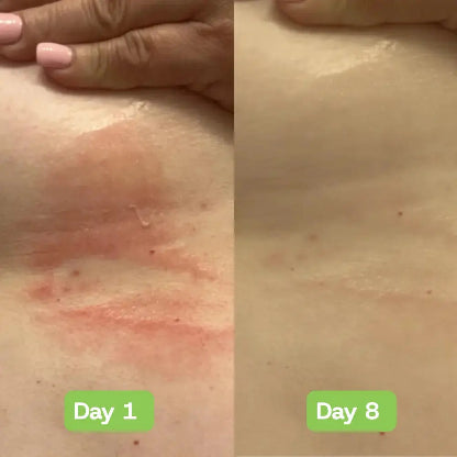 Veloria AntiFungal Relief - Veloria