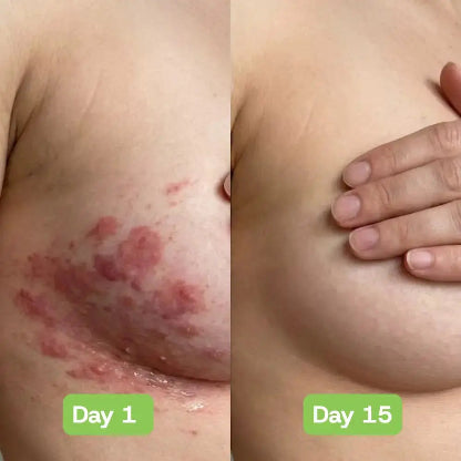 Veloria AntiFungal Relief - Veloria