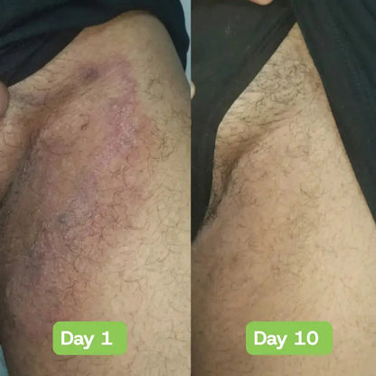 Veloria AntiFungal Relief - Veloria